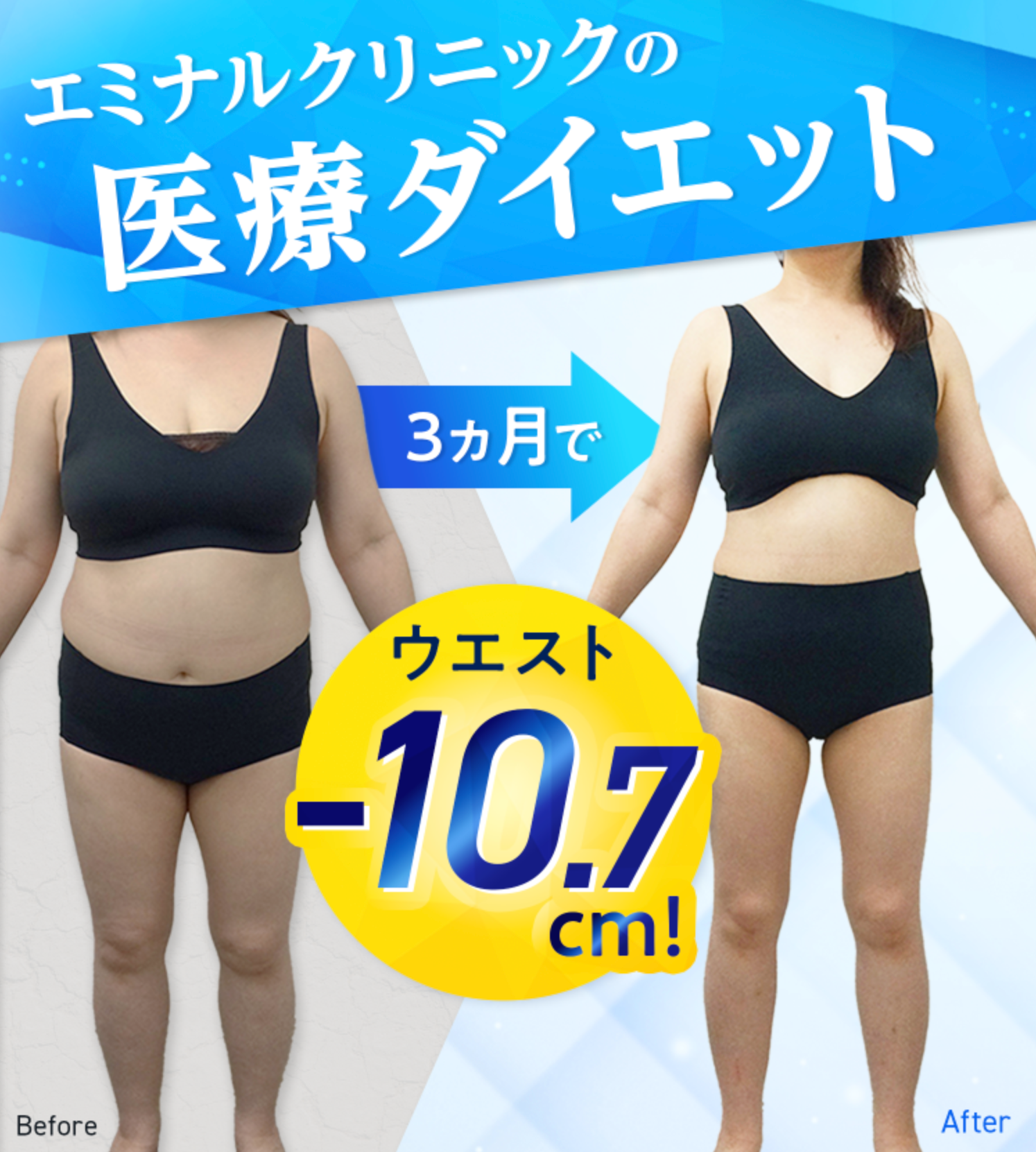 エミナルクリニックの医療ダイエット