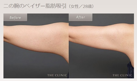 THE CLINICの症例写真