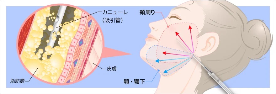 顔の脂肪